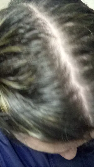 Kinetickatalyst, 18 years old from United States