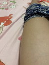 chinolam13y