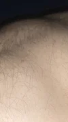 tomassito