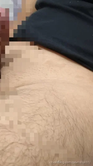 Close-up of hairy skin with dark fabric, possibly a man's torso or leg.