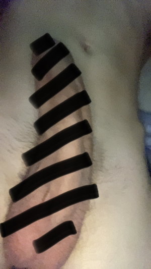 Censored male genitalia on white fluffy surface.