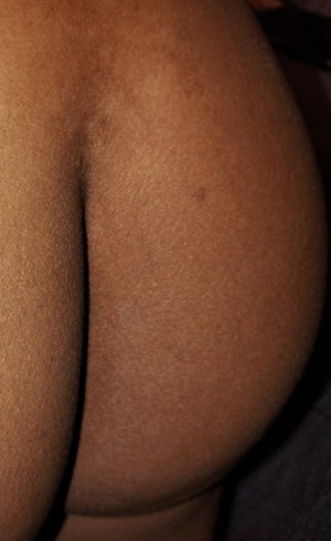 Close-up of bare dark-skinned buttocks.