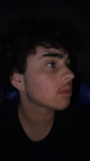 Young man with curly hair and acne in dark room.