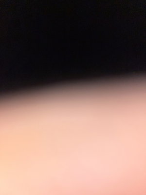 Blurry close-up of skin in dim lighting.