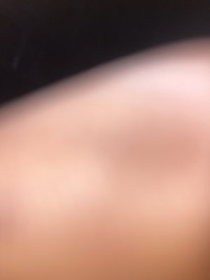 Close-up of skin and dark fabric, possibly clothing, in an unclear setting.