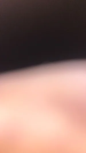 Blurred close-up of skin and dark fabric, unclear context.