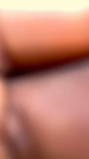 Blurred close-up of skin, possibly arm or leg, indistinct setting.