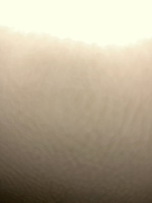 Close-up of blurred skin texture under bright light.
