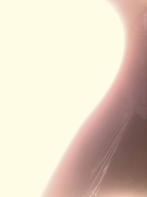 Close-up of bare skin with stretch marks.