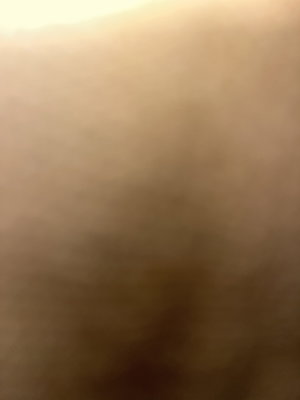 Blurred close-up of skin, indistinct features, no clear context.