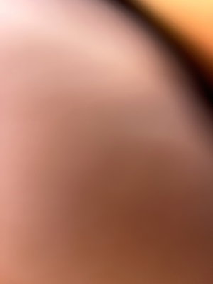 Blurred close-up of skin tone, no distinct features visible.