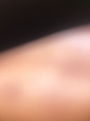 Blurred close-up of skin and dark fabric, indistinct features.