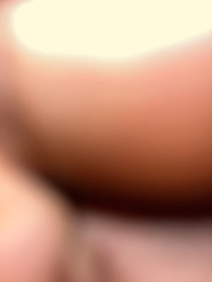 Blurred close-up of skin, possibly a body part, indistinct setting.