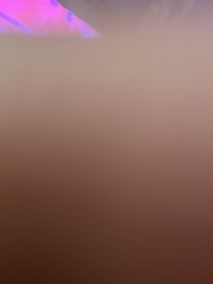 Blurry close-up of skin under pink and purple light.