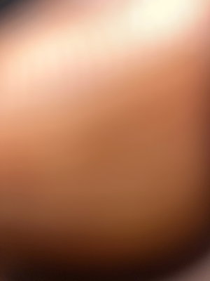 Blurry close-up of skin with bright light.