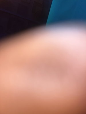 Blurry close-up of bare skin in dim light.