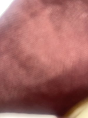 Close-up of skin with natural texture and slight discoloration.