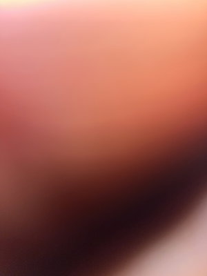 Blurred close-up of skin tones, no identifiable person or setting.