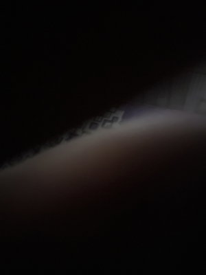 Close-up of skin with patterned fabric in dark setting.