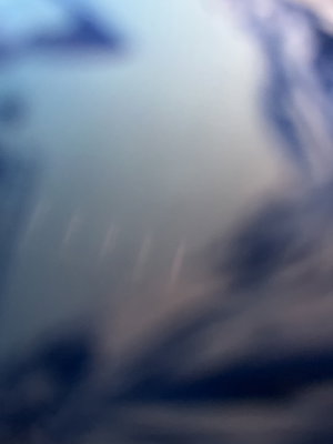 Blurry close-up of skin.