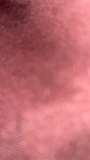 Close-up of skin texture, possibly arm or leg, with pinkish tone and fine lines.