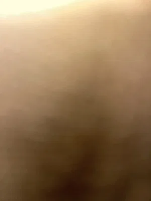 Blurred close-up of skin, possibly torso or leg, indistinct details.