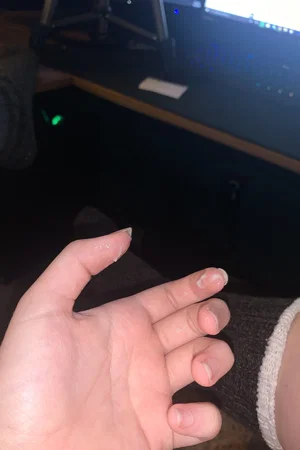 Close-up of a hand with chipped nail polish, wearing a dark sweater, in a dimly lit room with audio
