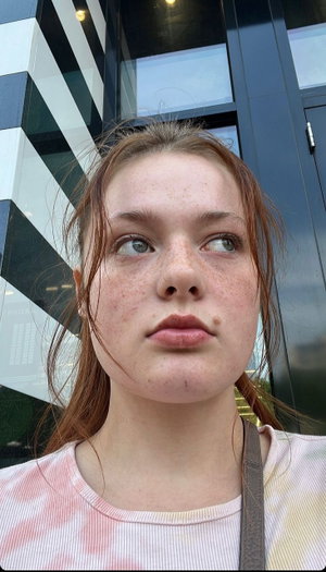 Woman with freckles and brown hair in a tie-dye shirt, standing outdoors near a modern building.
