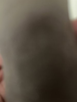 Blurry close-up of skin.