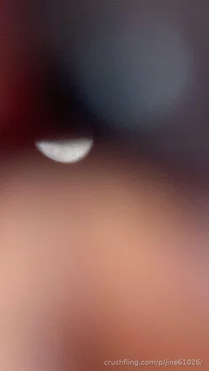 Blurred close-up of skin with a small white object, possibly a piercing or reflection.