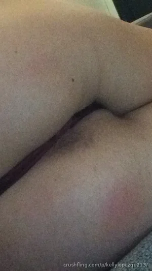 Close-up of bare legs and inner thigh, skin with minor blemishes, indoor setting.