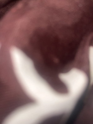 Blurry close-up of dark skin with white shape.
