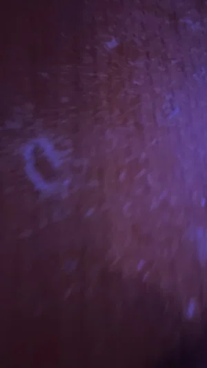 Blurred close-up of skin with purple lighting, no clear features or clothing visible.