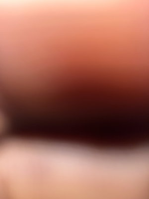 Blurred close-up of skin in warm tones.