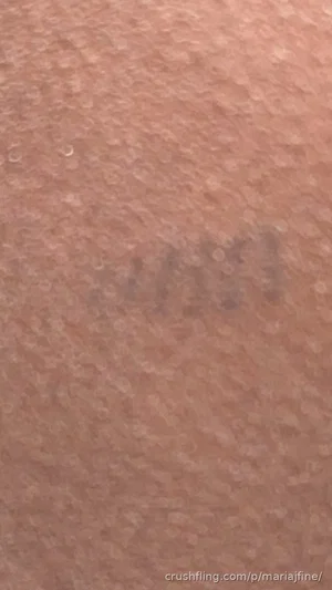 Close-up of skin with faint dark mark or tattoo.