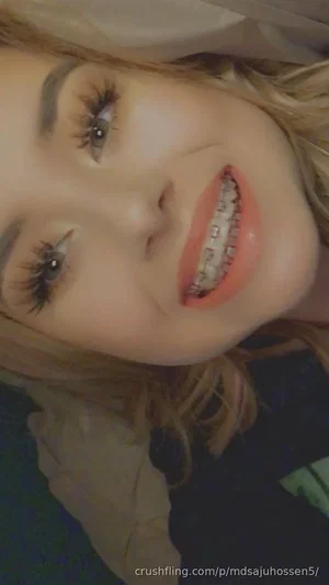 Woman with blonde hair and braces smiling in a close-up selfie indoors.