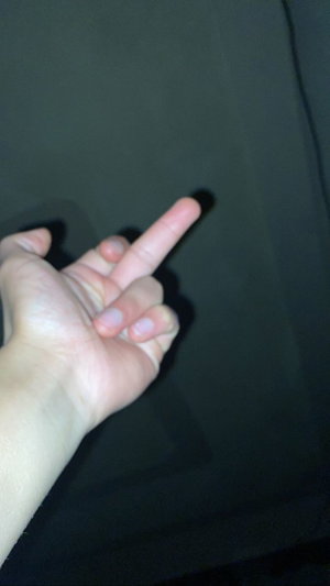 Hand making a peace sign against a dark background.