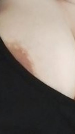 Close-up of a person's shoulder and upper chest, partially covered by black fabric.