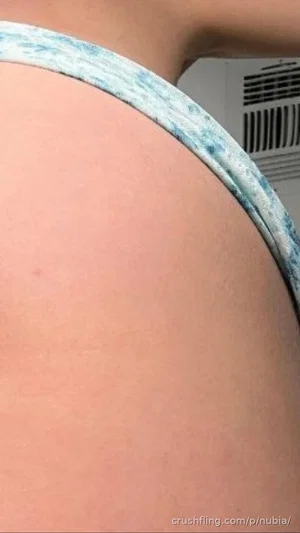 Close-up of a person's shoulder and upper back wearing a blue patterned strap, indoor setting.