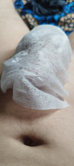 Close-up of lower torso with white tissue covering groin.