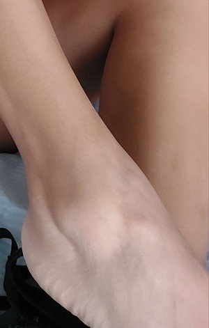 Close-up of bare legs and foot, possibly on bed, with black object nearby.