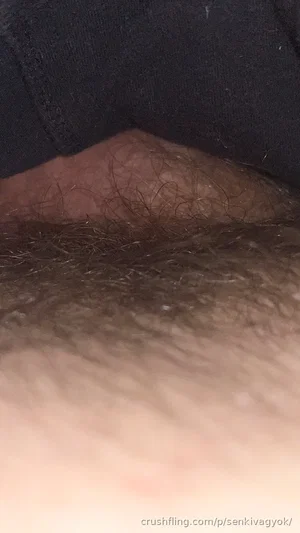 Close-up of hairy skin under black fabric, likely torso or pubic area.