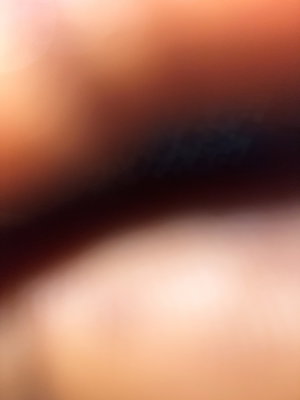 Blurry close-up of skin.