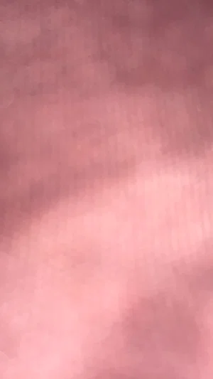 Blurred pink skin texture, no identifiable person or setting.