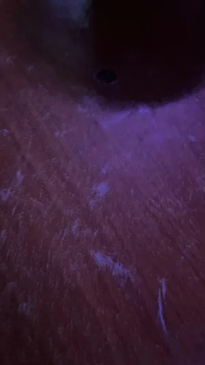 Close-up of textured skin under purple lighting, possibly a torso or leg.