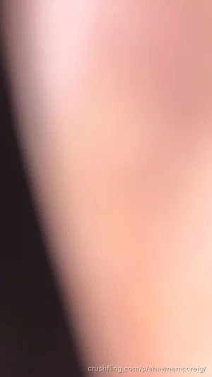 Close-up of skin, blurred, no clear features or clothing visible.