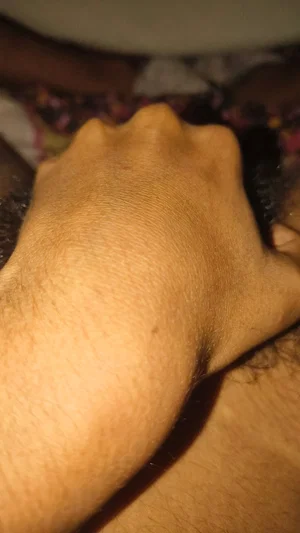 Close-up of a hand on a hairy leg, floral fabric visible in background.