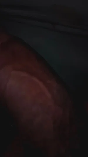 Blurry close-up of a person's body part in low light, indistinct details.