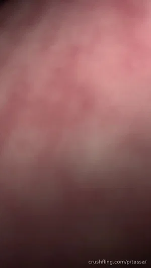 Blurred close-up of skin, no identifiable person or setting.